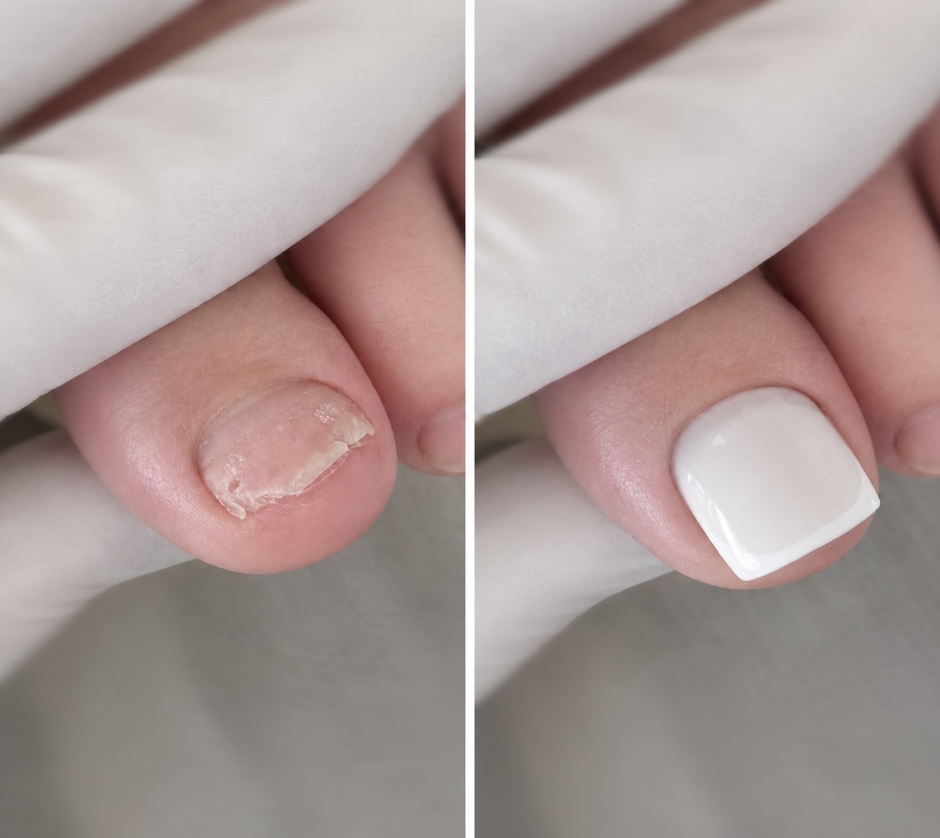 Ongle reconstitué — Beauty but Care