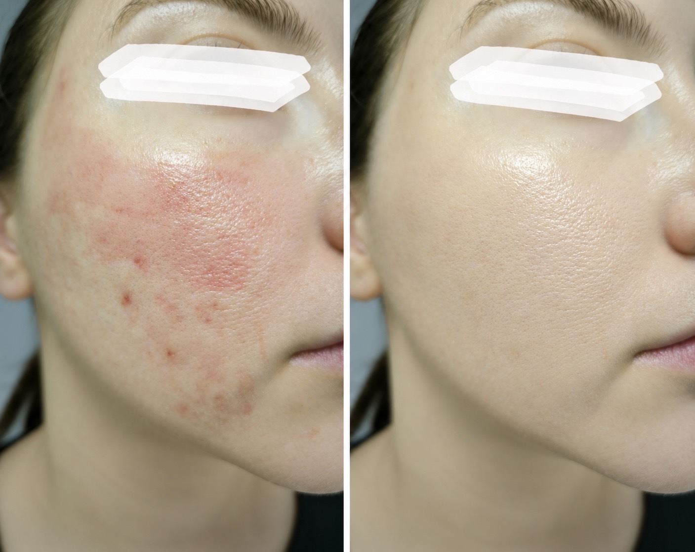 Peau — soin Nano therapy